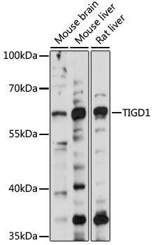 Western blot - TIGD1 Polyclonal Antibody 