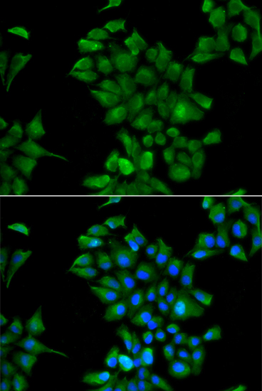 Immunofluorescence - CTNS Polyclonal Antibody 