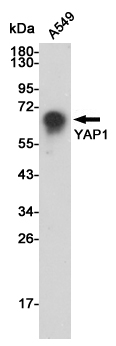 Western blot analysis of YAP1 expression in A549 cell lysates using YAP1 antibody at 1/500 dilution.Predicted band size:65KDa.Observed band size:65KDa.
