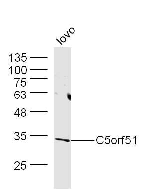 Fig1: Sample: Lovo Cell (Human) Lysate at 40 ug; Primary: Anti-C5orf51 at 1/300 dilution; Secondary: IRDye800CW Goat Anti-Rabbit IgG at 1/20000 dilution; Predicted band size: 34 kD; Observed band size: 34 kD