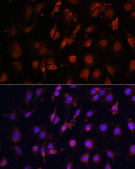Immunofluorescence - TET3 Polyclonal Antibody 