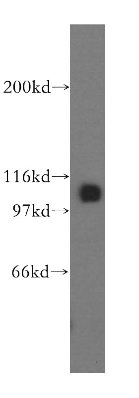 mouse testis tissue were subjected to SDS PAGE followed by western blot with Catalog No:112556(MCM6 antibody) at dilution of 1:500