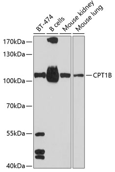 Western blot - CPT1B Polyclonal Antibody 
