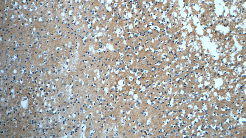 Immunohistochemistry of paraffin-embedded human brain tissue slide using Catalog No:110953(GFRA2 Antibody) at dilution of 1:50 (under 10x lens)
