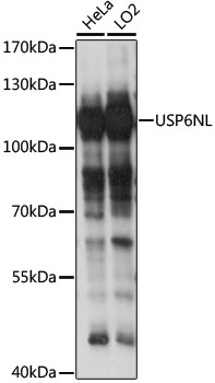 Western blot - USP6NL Polyclonal Antibody 