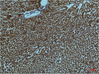Immunohistochemical analysis of paraffin-embedded Rat Liver Tissue using PI3 Kinase P85 α Mouse mAb diluted at 1:200.