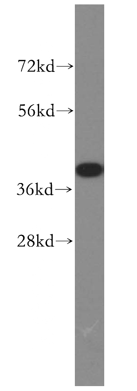 PC-3 cells were subjected to SDS PAGE followed by western blot with Catalog No:111640(NFKBIA antibody) at dilution of 1:500