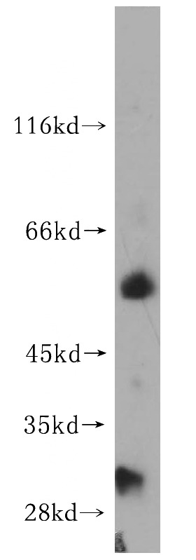 mouse spleen tissue were subjected to SDS PAGE followed by western blot with Catalog No:112066(KCNJ8 antibody) at dilution of 1:300