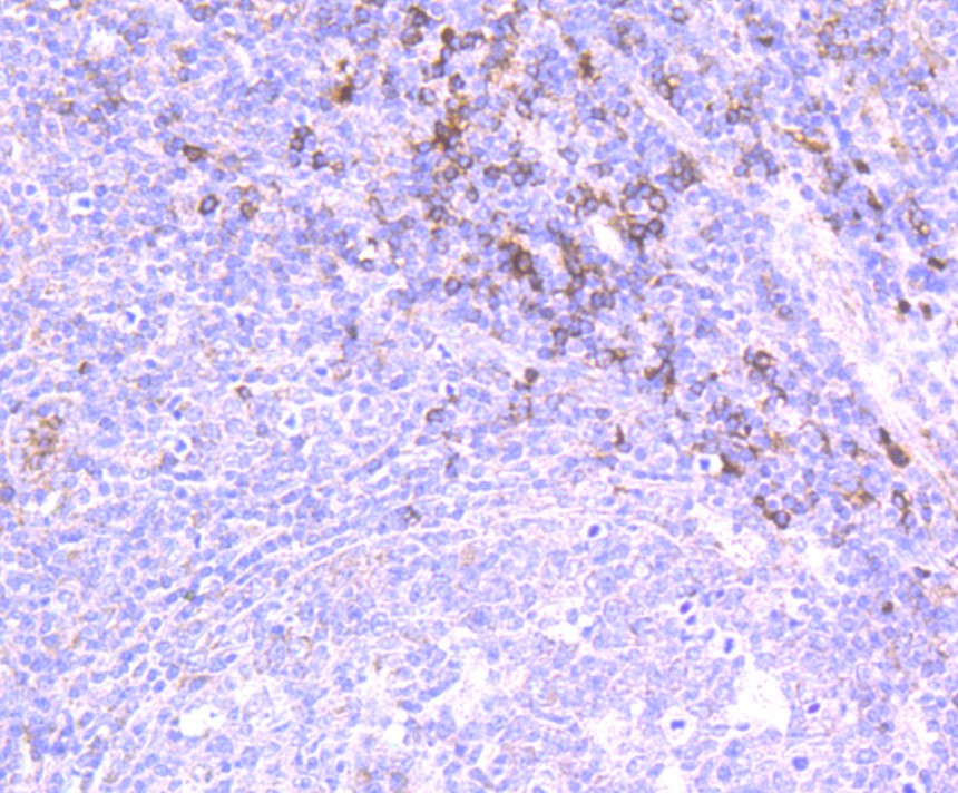 Fig5: Immunohistochemical analysis of paraffin-embedded human tonsil tissue using anti-IL-31 antibody. Counter stained with hematoxylin.