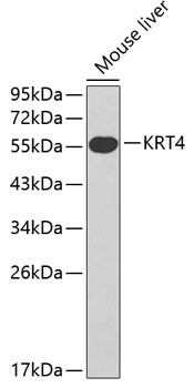 Western blot - KRT4 Polyclonal Antibody 
