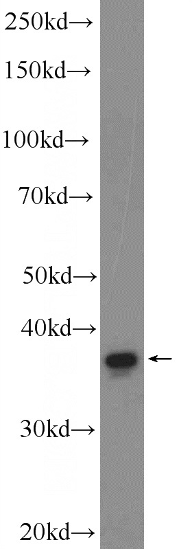 HEK-293 cells were subjected to SDS PAGE followed by western blot with Catalog No:109893(C10orf10 Antibody) at dilution of 1:600