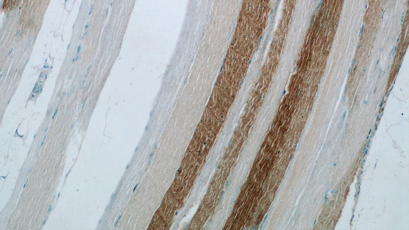 Immunohistochemical of paraffin-embedded human skeletal muscle using Catalog No:112181(LDHA antibody) at dilution of 1:50 (under 10x lens)