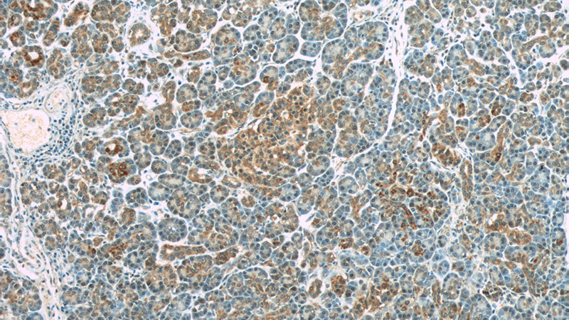Immunohistochemistry of paraffin-embedded human pancreas tissue slide using Catalog No:116823(WFDC3 Antibody) at dilution of 1:50 (under 10x lens)