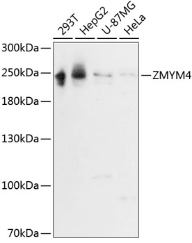 Western blot - ZMYM4 Polyclonal Antibody 