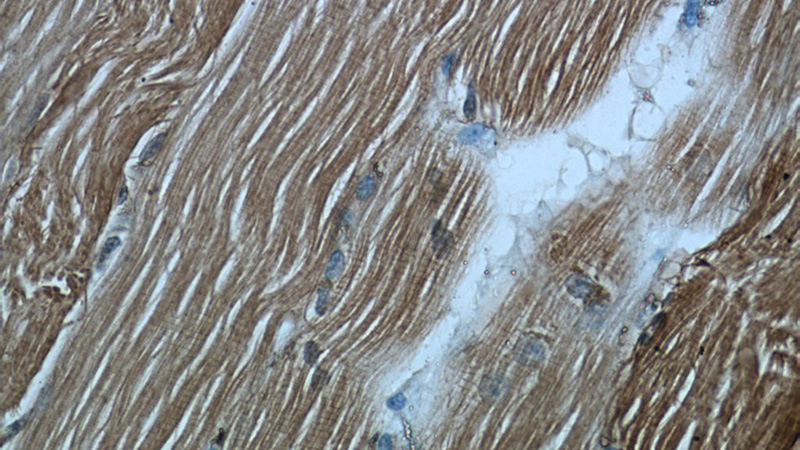 Immunohistochemical of paraffin-embedded human skeletal muscle using Catalog No:107976(ALDOA antibody) at dilution of 1:50 (under 40x lens)