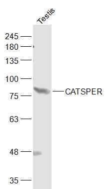 Fig1: Sample:; Testis (Mouse) Lysate at 40 ug; Primary: Anti-CATSPER at 1/1000 dilution; Secondary: IRDye800CW Goat Anti-Rabbit IgG at 1/20000 dilution; Predicted band size: 90 kD; Observed band size: 85 kD