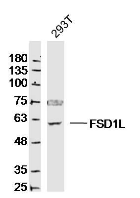 Fig1: Sample:; 293T Cell (Human) Lysate at 30 ug; Primary: Anti- FSD1L at 1/300 dilution; Secondary: IRDye800CW Goat Anti-Rabbit IgG at 1/20000 dilution; Predicted band size: 60kD; Observed band size: 60kD
