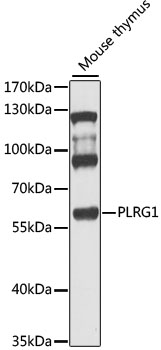 Western blot - PLRG1 Polyclonal Antibody 
