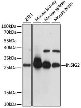 Western blot - INSIG2 Polyclonal Antibody 