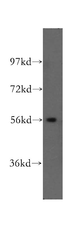 mouse heart tissue were subjected to SDS PAGE followed by western blot with Catalog No:115406(SMYD1-Specific antibody) at dilution of 1:500
