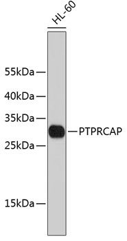 Western blot - PTPRCAP Polyclonal Antibody 