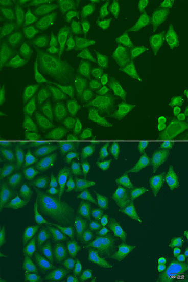 Immunofluorescence - SUGCT Polyclonal Antibody 