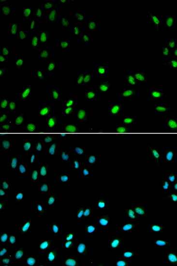 Immunofluorescence - RFC1 Polyclonal Antibody 