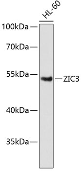 Western blot - ZIC3 Polyclonal Antibody 