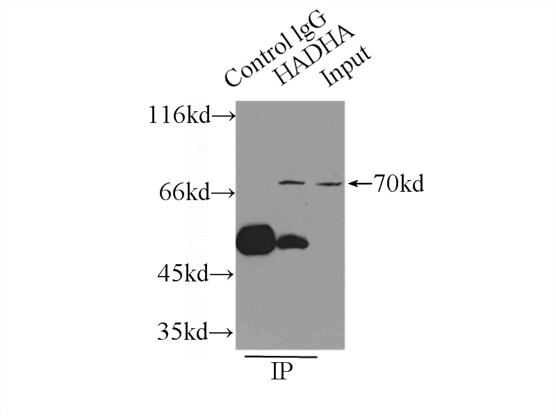 IP Result of anti-HADHA (IP:Catalog No:111333, 4ug; Detection:Catalog No:111333 1:200) with HEK-293 cells lysate 2500ug.
