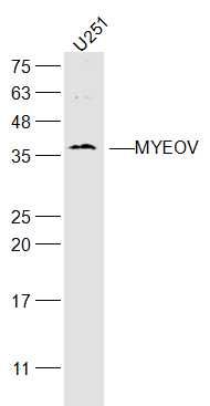 Fig1: Sample:; U251(Human) Cell Lysate at 40 ug; Primary: Anti-MYEOV at 1/300 dilution; Secondary: IRDye800CW Goat Anti-Rabbit IgG at 1/20000 dilution; Predicted band size: 34 kD; Observed band size: 36 kD