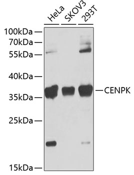 Western blot - CENPK Polyclonal Antibody 