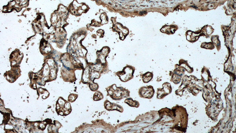 Immunohistochemistry of paraffin-embedded human placenta tissue slide using (CDH3 Antibody) at dilution of 1:500 (under 10x lens)