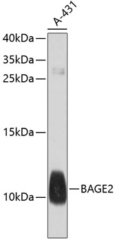 Western blot - BAGE2 Polyclonal Antibody 