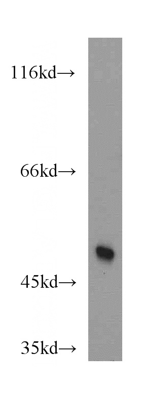 A431 cells were subjected to SDS PAGE followed by western blot with Catalog No:112372(MAF antibody) at dilution of 1:500