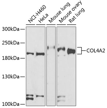 Western blot - COL4A2 Polyclonal Antibody 