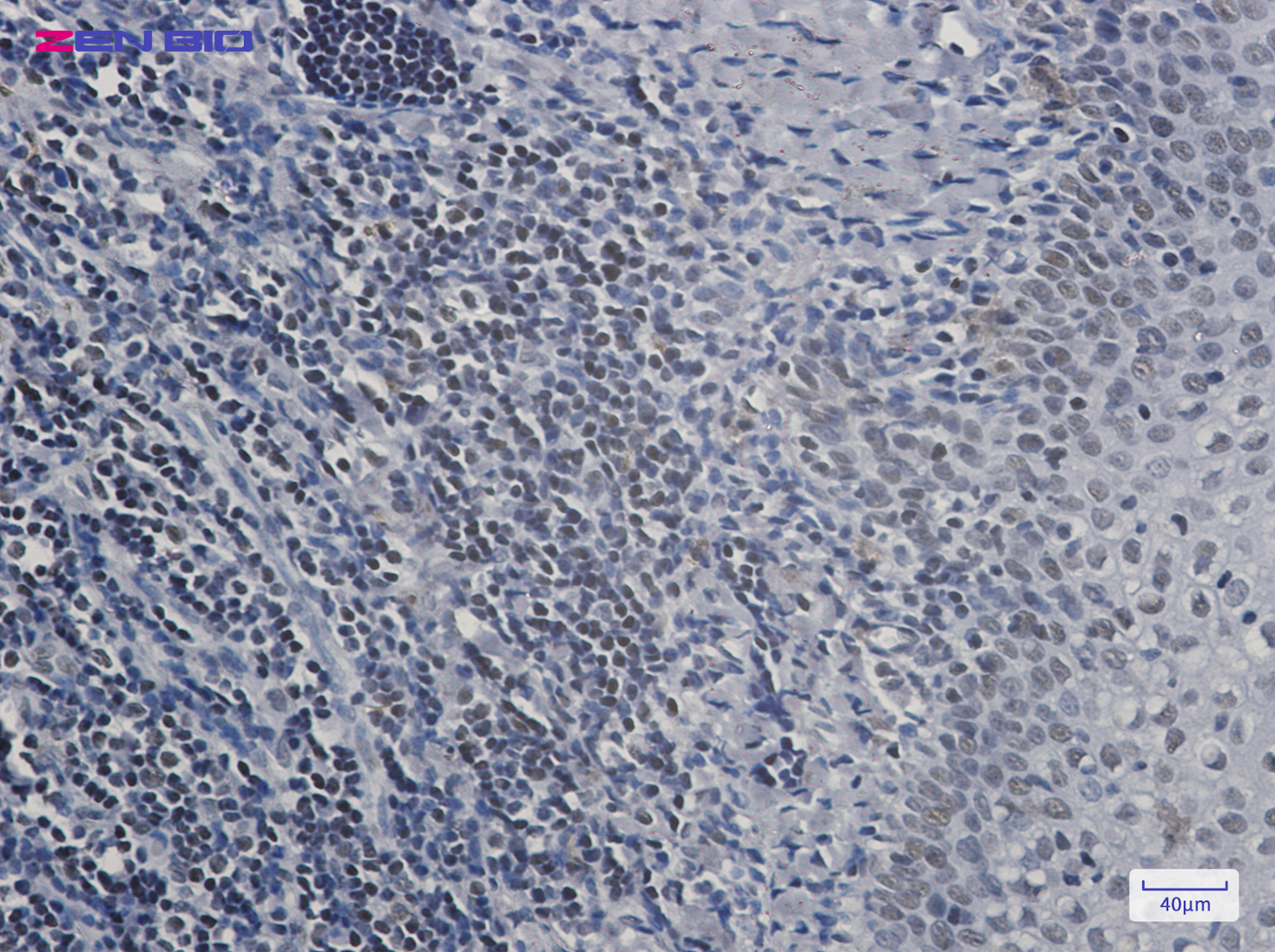Immunohistochemistry of RPA32/RPA2 in paraffin-embedded Human tonsil using RPA32/RPA2 Rabbit pAb at dilution 1/50