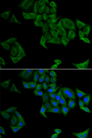 Immunofluorescence - SMYD5 Polyclonal Antibody 