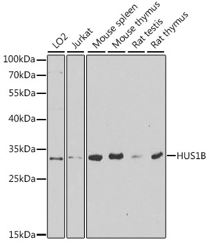 Western blot - HUS1B Polyclonal Antibody 