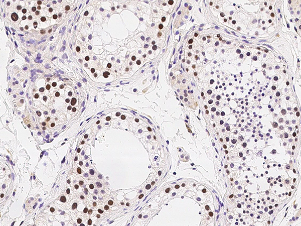 RAD18 Antibody, Rabbit PAb, Antigen Affinity Purified, Immunohistochemistry