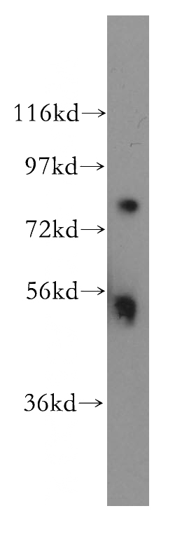 mouse testis tissue were subjected to SDS PAGE followed by western blot with Catalog No:110563(FBXW2 antibody) at dilution of 1:500