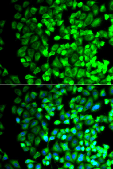 Immunofluorescence - TBXAS1 Polyclonal Antibody 