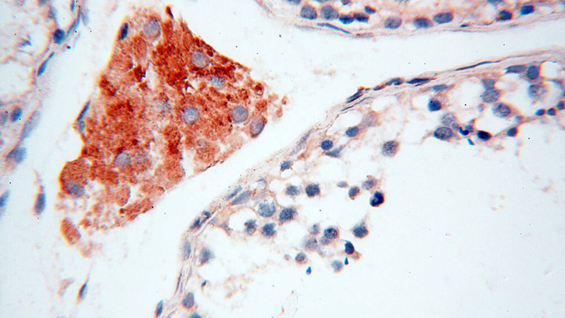 Immunohistochemical of paraffin-embedded human testis using Catalog No:111844(INPP5E antibody) at dilution of 1:50 (under 40x lens)