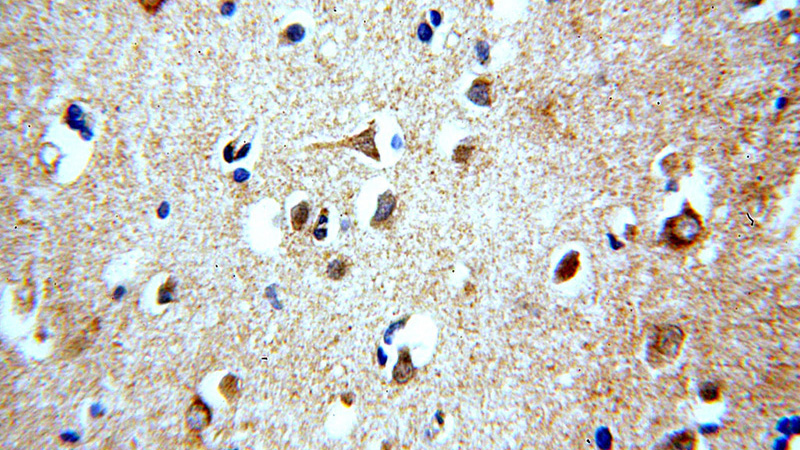 Immunohistochemical of paraffin-embedded human brain using Catalog No:115588(SRGAP3-Specific antibody) at dilution of 1:100 (under 40x lens)