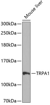 Western blot - TRPA1 Polyclonal Antibody 