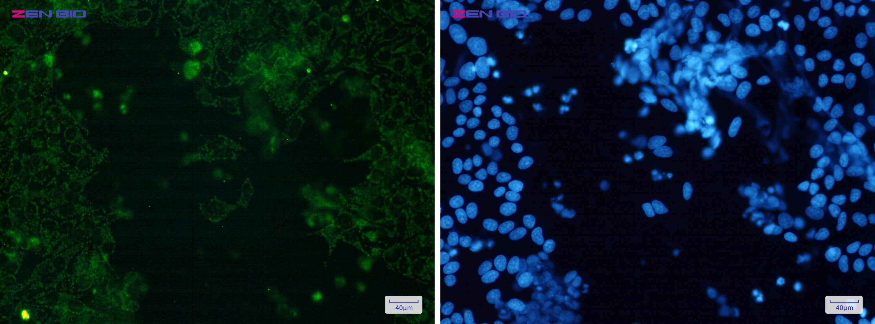 Immunocytochemistry of Cytochrome P450 17A1(green) in Hela cells using Cytochrome P450 17A1 Rabbit pAb at dilution 1/50, and DAPI(blue)