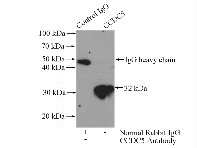 IP Result of anti-CCDC5 (IP:Catalog No:108976, 4ug; Detection:Catalog No:108976 1:500) with HeLa cells lysate 1200ug.