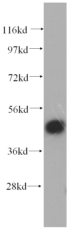human adrenal gland tissue were subjected to SDS PAGE followed by western blot with Catalog No:114389(PSMC2 antibody) at dilution of 1:500