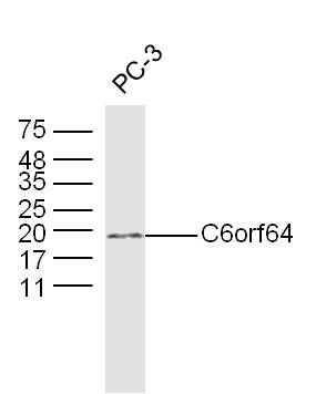Fig2: Sample: PC-3 Cell (Human) Lysate at 40 ug; Primary: Anti-C6orf64 at 1/300 dilution; Secondary: IRDye800CW Goat Anti-Rabbit IgG at 1/20000 dilution; Predicted band size: 20 kD; Observed band size: 20 kD