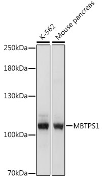 Western blot - MBTPS1 Polyclonal Antibody 