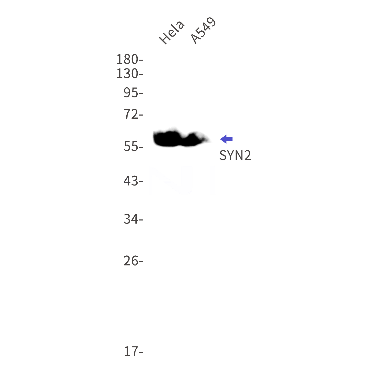 Western blot detection of SYN2 in Hela,A549 cell lysates using SYN2 Rabbit mAb(1:1000 diluted).Predicted band size:63kDa.Observed band size:63kDa.